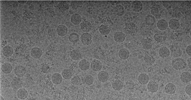 Làm thế nào các nhà khoa học chụp được ảnh virus?