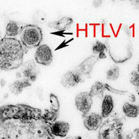 Virus cổ xưa có "họ hàng với HIV" đột nhiên trỗi dậy