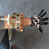 “Găng tay” chụp cộng hưởng từ: Phát kiến cho giải phẫu bàn tay