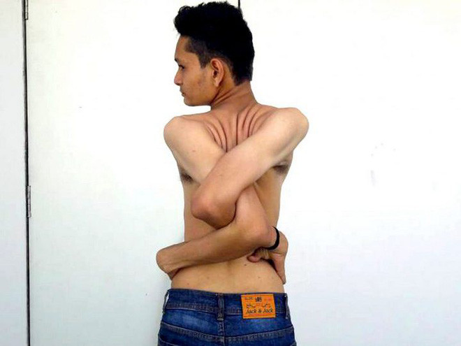 Chàng trai Ấn Độ có cơ thể uốn dẻo như cao su, uốn vai 360 độ và xoay cổ 180 độ
