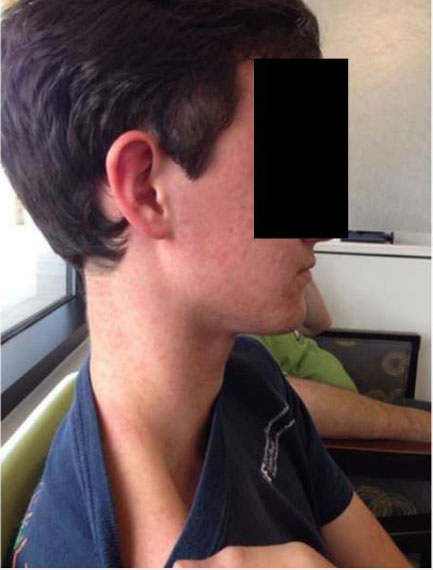 Phát hiện thêm một virus do muỗi truyền sang người