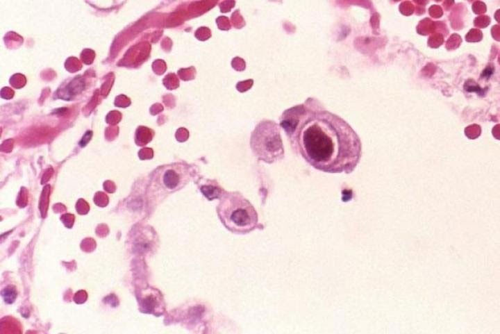 Tìm ra loại virus có thể giúp tăng cường miễn dịch cho người cao tuổi