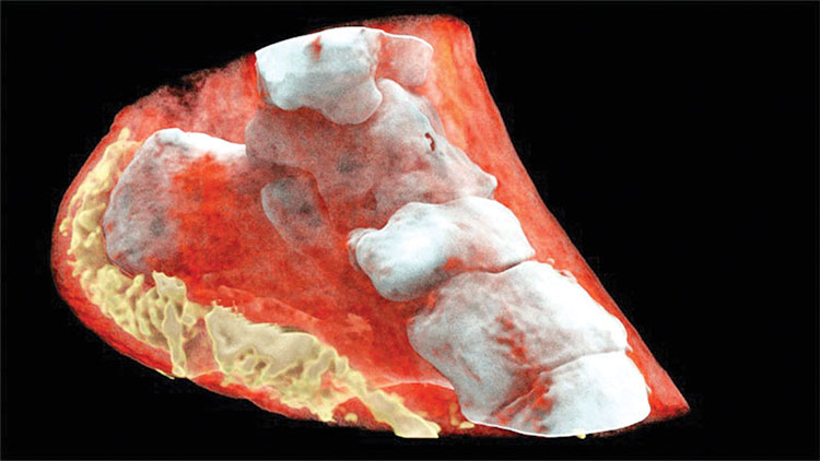 Đây là hình ảnh X-quang màu 3D đầu tiên trên thế giới, đừng xem nếu bạn yếu tim