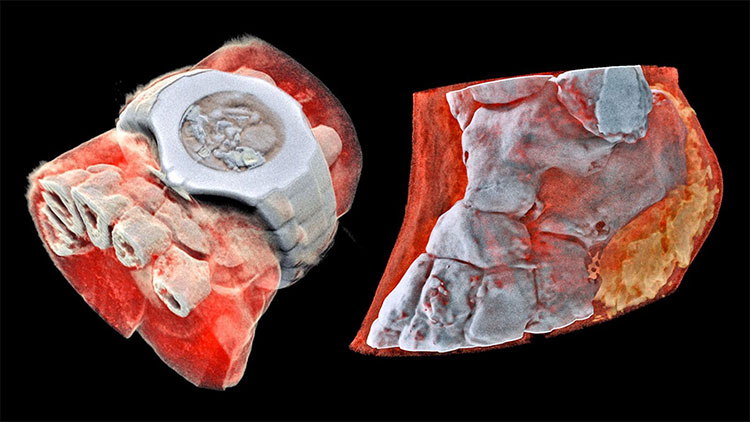 Đây là hình ảnh X-quang màu 3D đầu tiên trên thế giới, đừng xem nếu bạn yếu tim