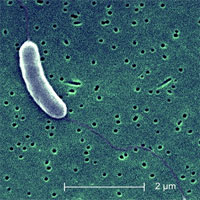 Biến đổi khí hậu và sự sinh sôi của "vi khuẩn ăn thịt người"