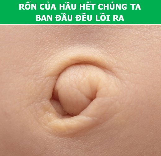 Bất ngờ trước những sự thật khoa học về… chiếc rốn
