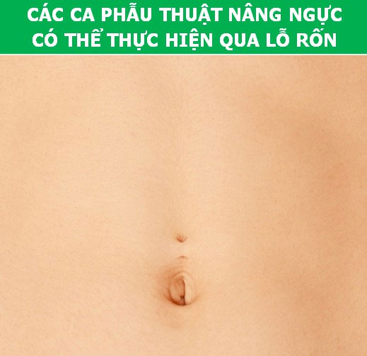 Bất ngờ trước những sự thật khoa học về… chiếc rốn