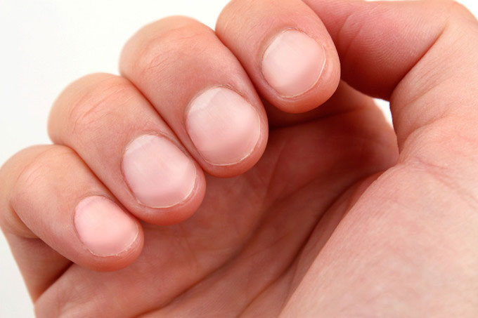 Dấu hiệu trên bàn tay tiết lộ bạn đang mắc bệnh gì