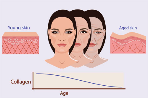 Vì sao nếp nhăn lại xuất hiện khi ta 
