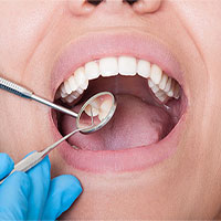 Vì sao cần khám răng trước khi phẫu thuật ung thư?