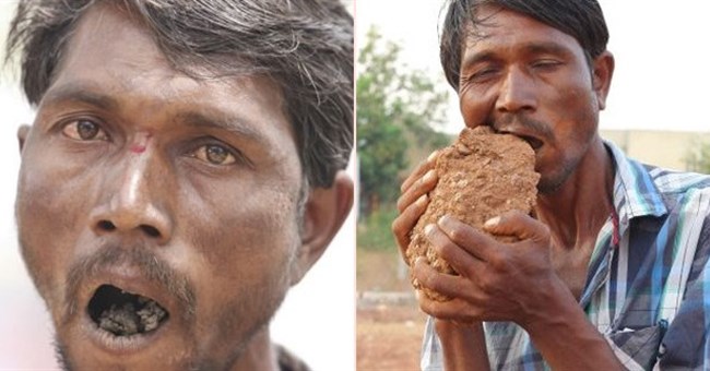 Hãi hùng dị nhân ăn 3kg bùn đất mỗi ngày, nhai gạch như bim bim