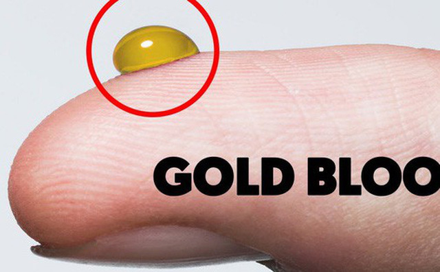 Kinh ngạc với nhóm máu được ví với 