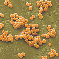 Vi khuẩn tụ cầu vàng xâm nhập qua thực phẩm nguy hiểm thế nào?