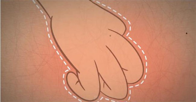 Tại sao gãi ngứa lại dễ chịu đến vậy?