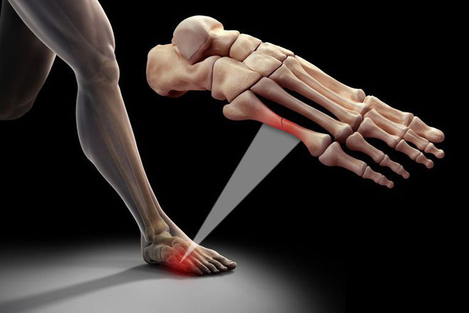 5 điều mọi người hay hiểu lầm về xương