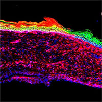 Đột phá công nghệ tế bào giúp chữa lành vết thương lớn trên da