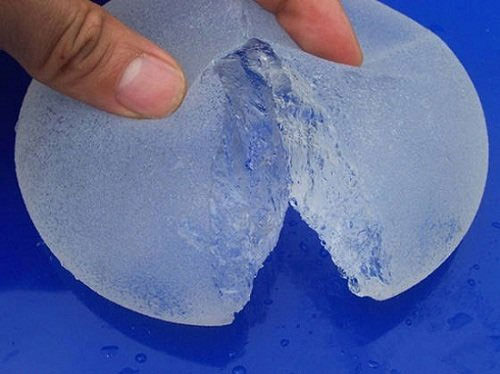 Đi máy bay có khiến túi ngực bị vỡ? Xem bác sĩ thế giới nói gì?