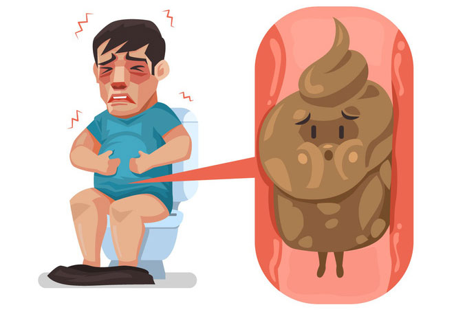 Dân văn phòng chú ý! Khi thấy những dấu hiệu này rất có thể bạn đang bị trĩ rồi đấy
