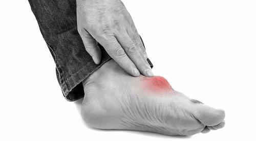 Tăng axit uric máu: Nguyên nhân, triệu chứng và cách điều trị