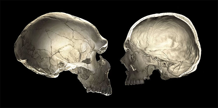 Những người đầu hơi bẹp là do gene di truyền của người Neanderthal