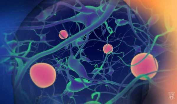 Giày Laser hỗ trợ bệnh nhân Parkinson đi lại