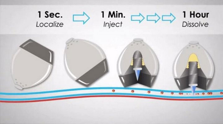 Đã tìm ra cách điều trị tiểu đường bằng insulin không tiêm qua da
