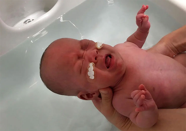 Cậu bé nhỏ nhất thế giới: 268g vẫn sống sót!