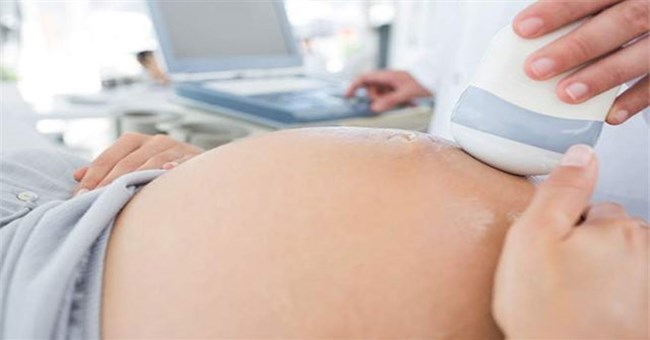 Cặp sinh đôi thể cực thứ hai trên thế giới: Hai tinh trùng thụ tinh một trứng