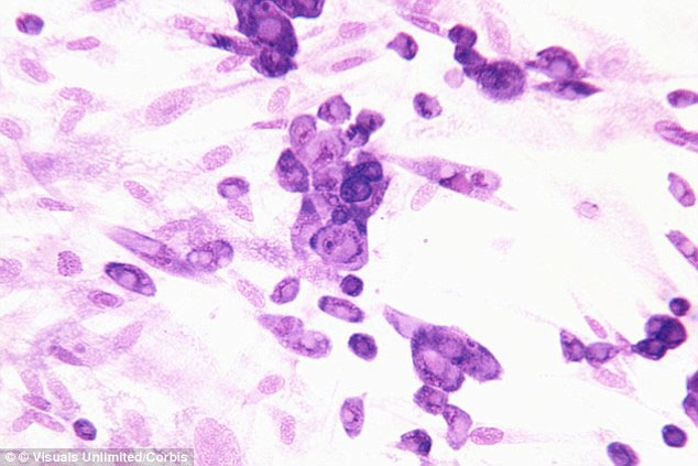Virus sinh dục bùng phát trên vũ trụ - chuyện gì đang xảy ra thế này?