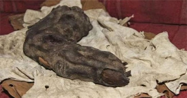 Giật mình ngón tay “khủng” có thật của người khổng lồ