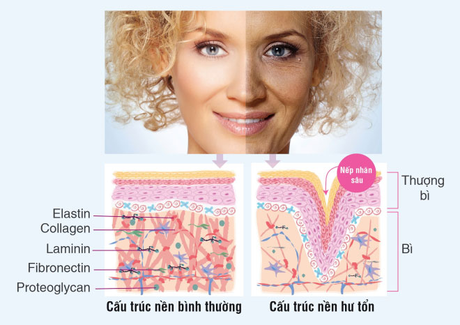 Hiểm họa cho làn da từ tia UV trong ngày nắng nóng