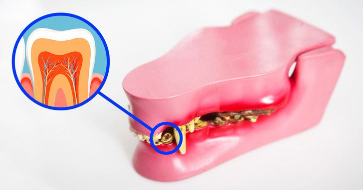 Các nhà khoa học đã tìm ra cách giúp bạn mọc lại răng mới chỉ sau 2 tháng