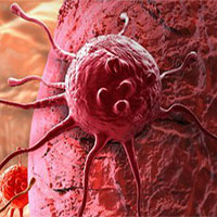 Vì sao tế bào ung thư lan nhanh bất thường?