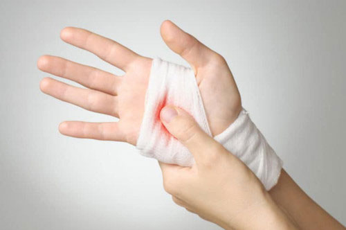 Cách sơ cứu khi bị đứt tay