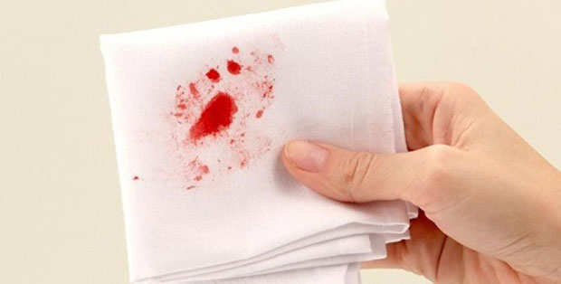3 dấu hiệu mà nhiều người thường nhầm lẫn giữa bệnh ung thư ruột và bệnh trĩ