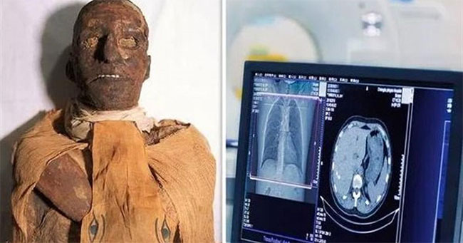 Chụp cắt lớp xác ướp pharaoh Ai Cập 3.000 tuổi, phát hiện bí mật choáng váng