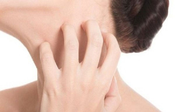 13 nguyên nhân gây ngứa khắp người càng gãi càng ngứa