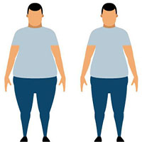 Hiểu về phẫu thuật giảm béo: Phương pháp cứu cánh cho những người thừa cân quá độ