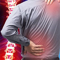 Cảnh giác với những cơn đau lưng