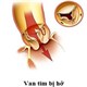 Bệnh hở van tim là gì?