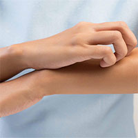 Những hội chứng rối loạn kỳ quái nhất thế giới