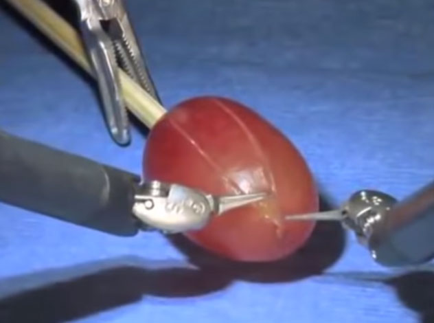 Màn trình diễn “mổ”…một quả nho.