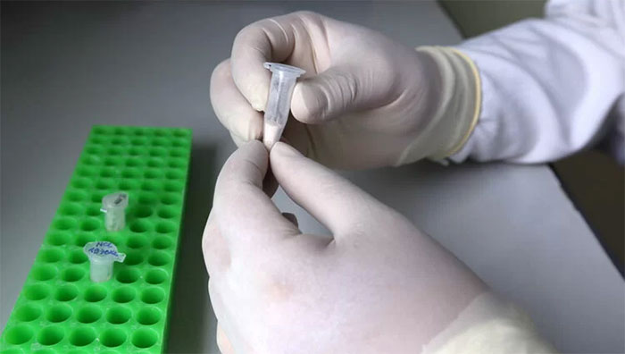 Nghiên cứu về hệ gene người Việt tìm ra nhiều bệnh hiếm gặp