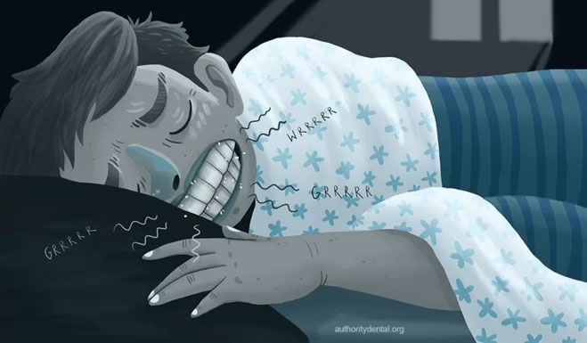 Tìm hiểu về bệnh nghiến răng