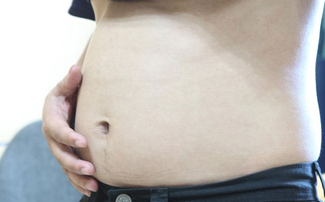Chướng bụng dưới là gì và những nguyên nhân gây chướng bụng dưới