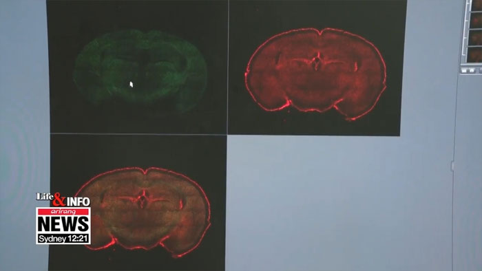 Phòng và trị bệnh Alzheimer nhờ bột tằm sấy khô?