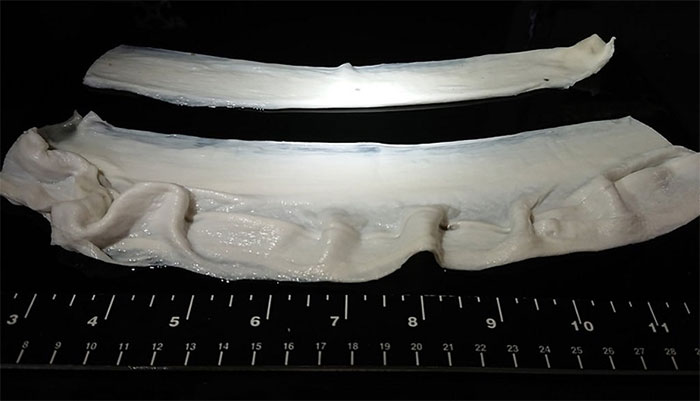 Dùng gelatin làm “giàn giáo” để tạo cơ cho thịt nhân tạo
