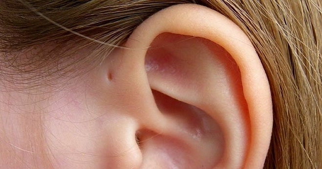 Đặc điểm hiếm có trên cơ thể người