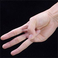 Chỉ với 3 ngón tay, bạn có thể tự kiểm tra xem mình đang có nguy cơ mắc bệnh ung thư hay không