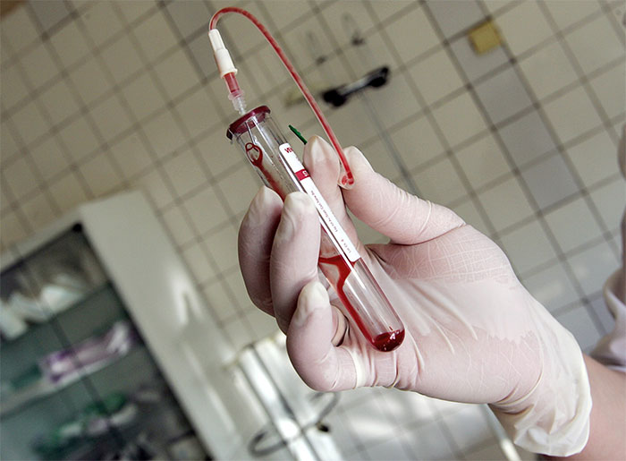 Phát hiện thêm chủng HIV mới